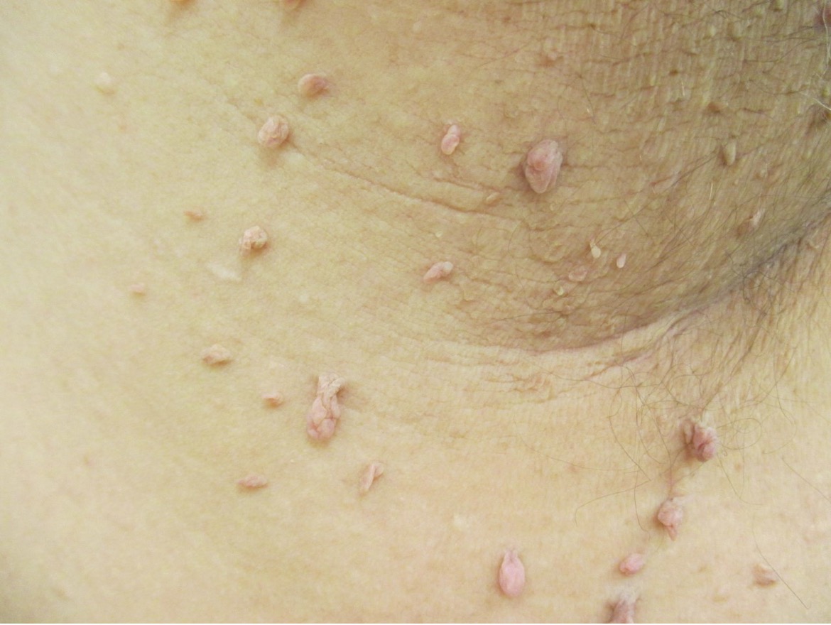 An Atlas of Lumps and Bumps Part 5 Consultant360